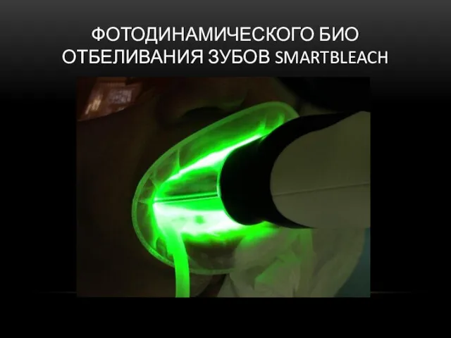 ФОТОДИНАМИЧЕСКОГО БИО ОТБЕЛИВАНИЯ ЗУБОВ SMARTBLEACH