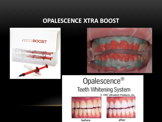 OPALESCENCE XTRA BOOST