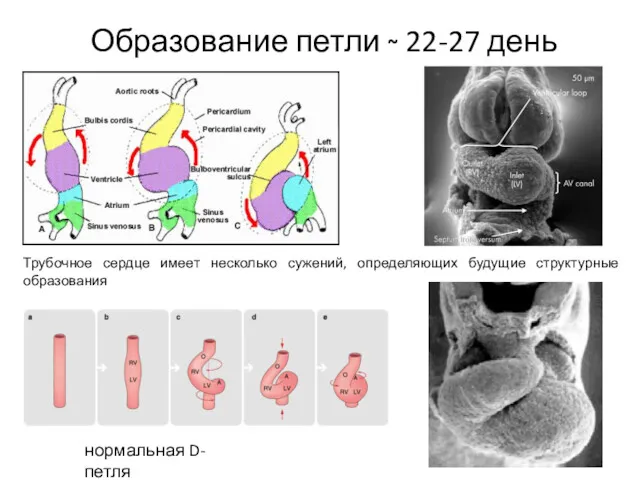 Образование петли ~ 22-27 день нормальная D-петля Трубочное сердце имеет несколько сужений, определяющих будущие структурные образования