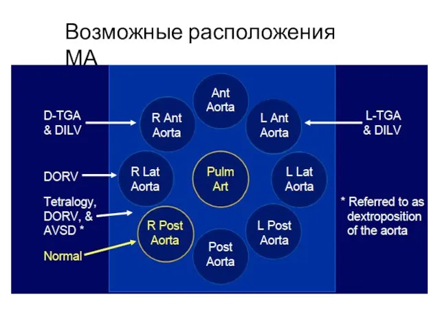 Возможные расположения МА