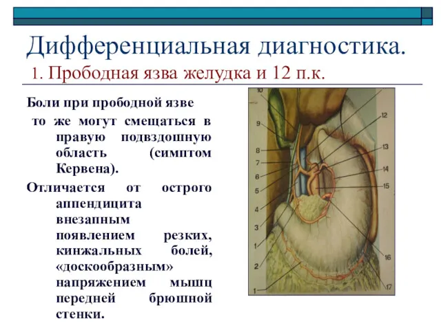 Дифференциальная диагностика. 1. Прободная язва желудка и 12 п.к. Боли