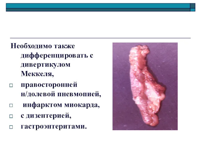 Необходимо также дифференцировать с дивертикулом Меккеля, правосторонней н/долевой пневмопией, инфарктом миокарда, с дизентерией, гастроэнтеритами.