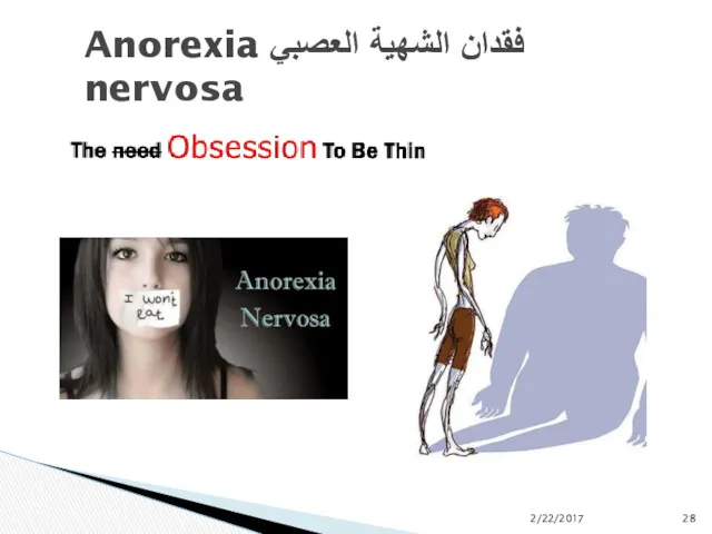 فقدان الشهية العصبي Anorexia nervosa 2/22/2017