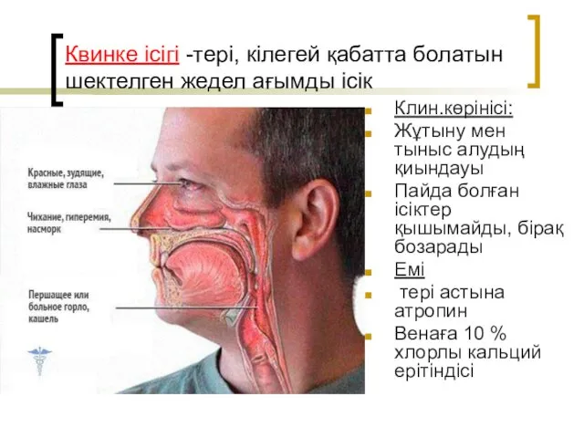 Квинке ісігі -тері, кілегей қабатта болатын шектелген жедел ағымды ісік