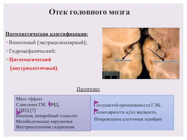 Отек головного мозга Патогенетическая классификация: Вазогенный (экстрацелюллярный); Гидроцефалический; Цитотоксический (внутриклеточный).