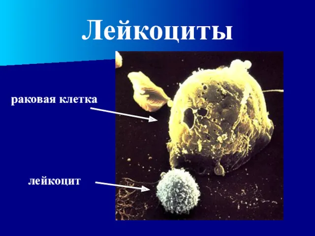 Лейкоциты раковая клетка лейкоцит