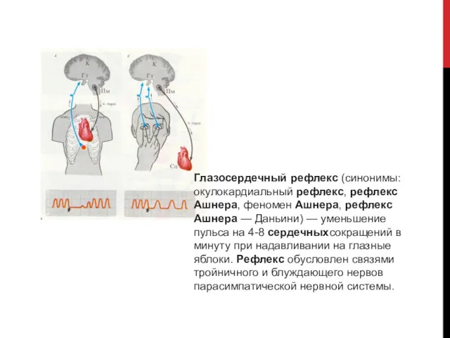 Глазосердечный рефлекс (синонимы: окулокардиальный рефлекс, рефлекс Ашнера, феномен Ашнера, рефлекс