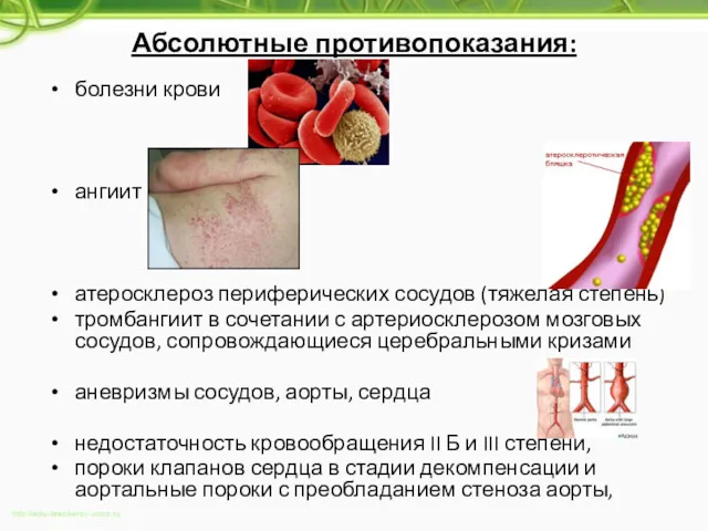 Абсолютные противопоказания: болезни крови ангиит атеросклероз периферических сосудов (тяжелая степень)