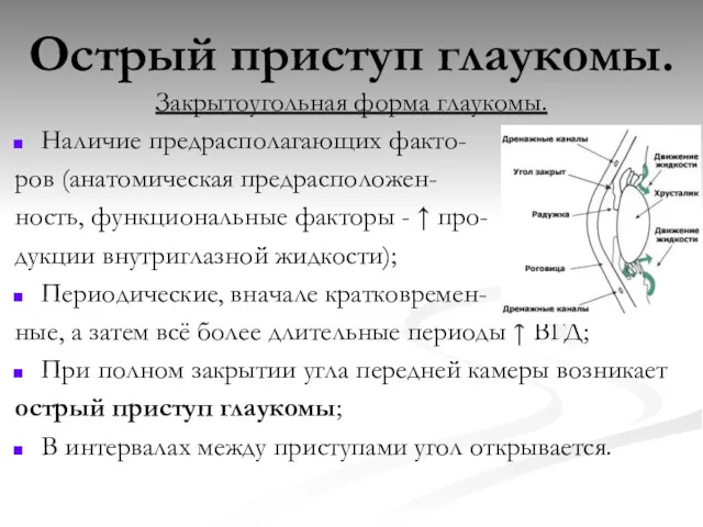 Острый приступ глаукомы. Закрытоугольная форма глаукомы. Наличие предрасполагающих факто- ров