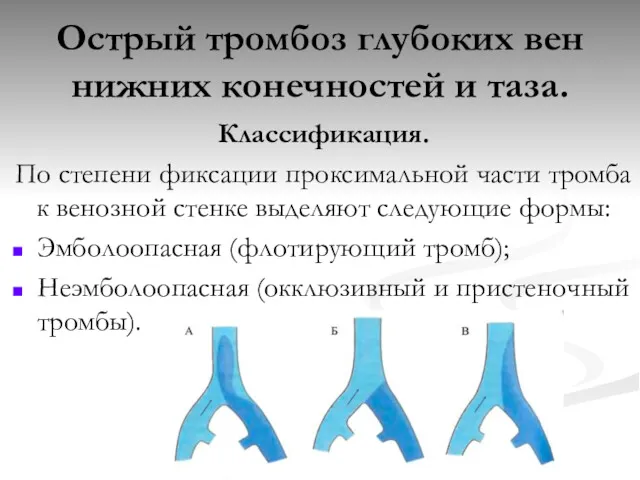 Острый тромбоз глубоких вен нижних конечностей и таза. Классификация. По