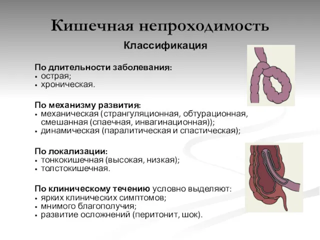 Кишечная непроходимость Классификация По длительности заболевания: острая; хроническая. По механизму