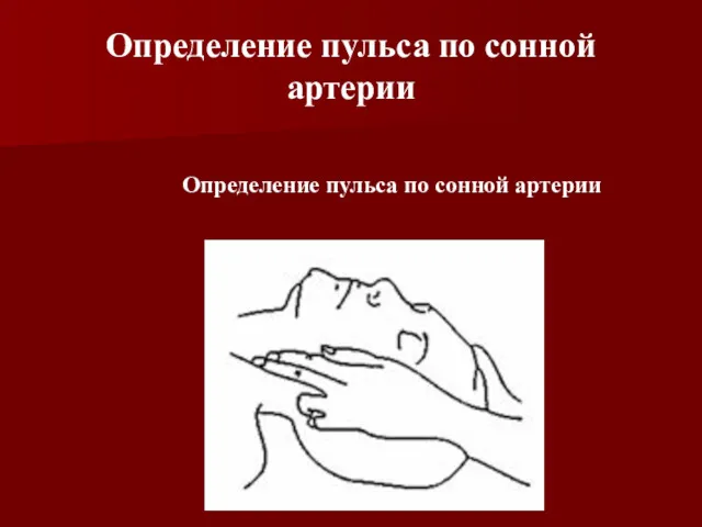 Определение пульса по сонной артерии Определение пульса по сонной артерии