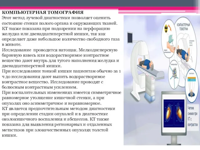 КОМПЬЮТЕРНАЯ ТОМОГРАФИЯ Этот метод лучевой диагностики позволяет оценить состояние стенки