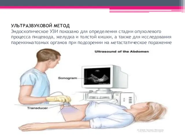 УЛЬТРАЗВУКОВОЙ МЕТОД Эндоскопическое УЗИ показано для определения стадии опухолевого процесса