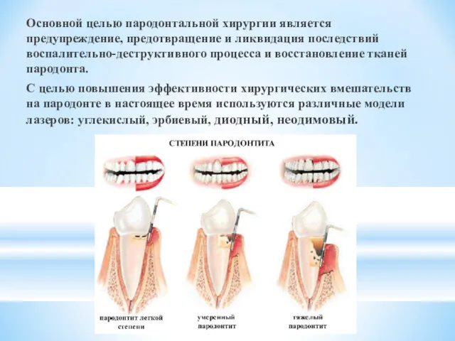 Основной целью пародонтальной хирургии является предупреждение, предотвращение и ликвидация по­следствий