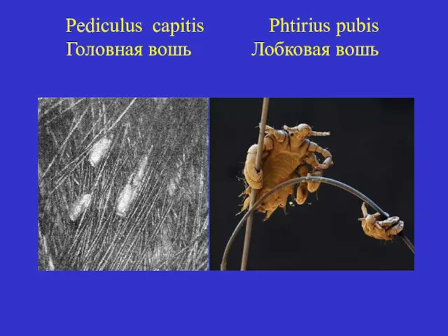 Pediculus capitis Phtirius pubis Головная вошь Лобковая вошь