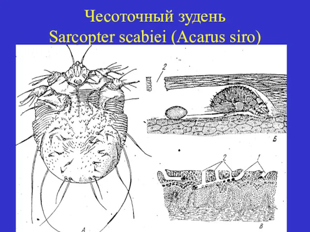 Чесоточный зудень Sarcopter scabiei (Acarus siro)