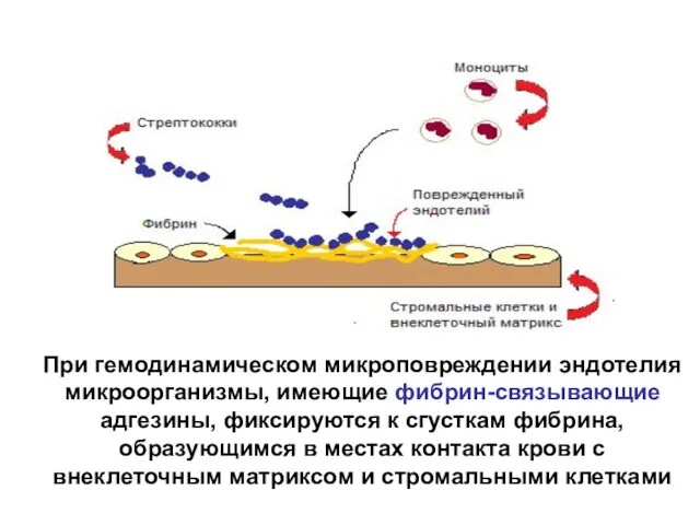 При гемодинамическом микроповреждении эндотелия микроорганизмы, имеющие фибрин-связывающие адгезины, фиксируются к