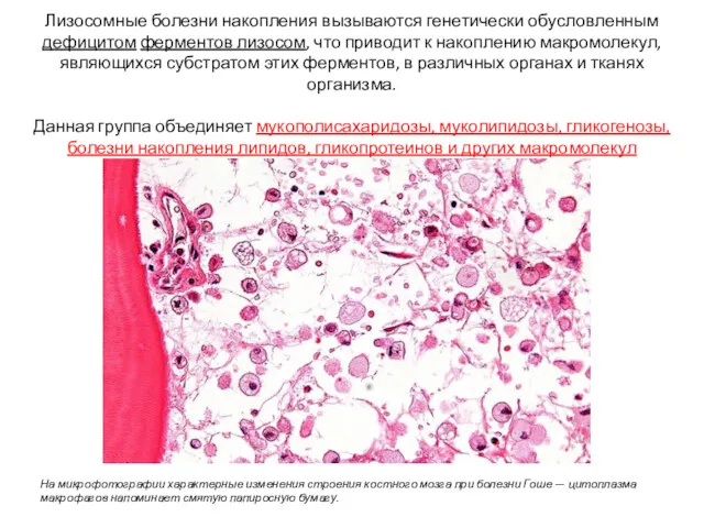 Лизосомные болезни накопления вызываются генетически обусловленным дефицитом ферментов лизосом, что