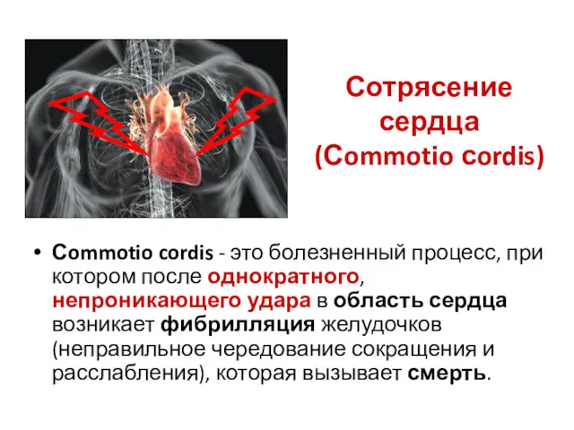 Сотрясение сердца (Сommotio сordis) Сommotio cordis - это болезненный процесс,