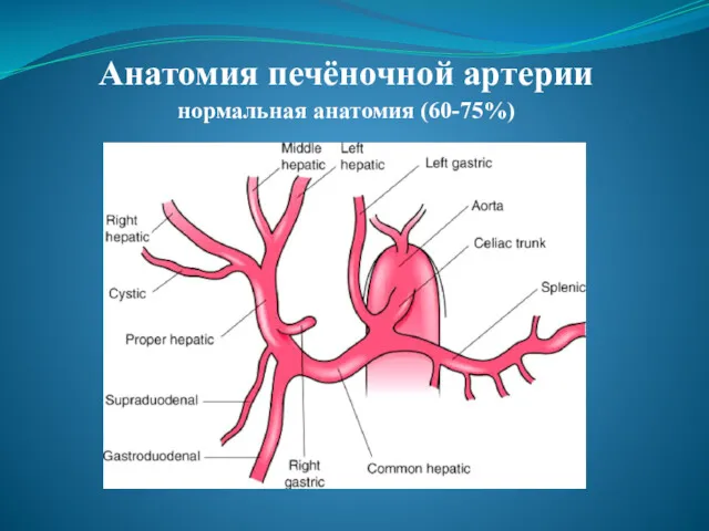 Анатомия печёночной артерии нормальная анатомия (60-75%)