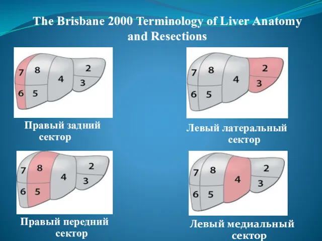 The Brisbane 2000 Terminology of Liver Аnatomy and Resections Правый