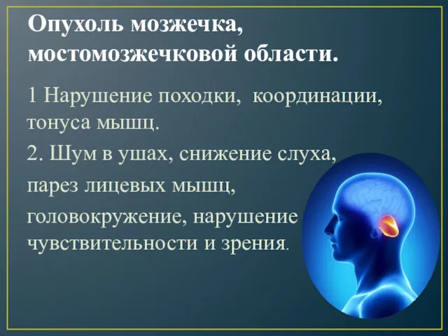 Опухоль мозжечка, мостомозжечковой области. 1 Нарушение походки, координации, тонуса мышц. 2. Шум в