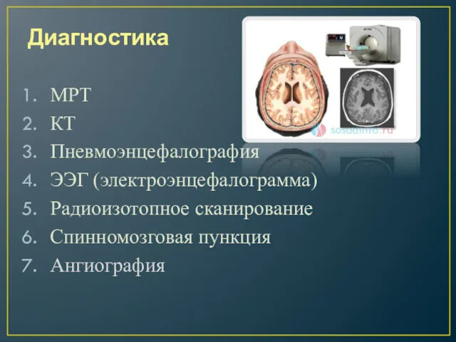 Диагностика МРТ КТ Пневмоэнцефалография ЭЭГ (электроэнцефалограмма) Радиоизотопное сканирование Спинномозговая пункция Ангиография