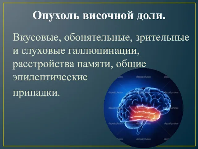 Опухоль височной доли. Вкусовые, обонятельные, зрительные и слуховые галлюцинации, расстройства памяти, общие эпилептические припадки.