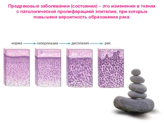 Предраковые заболевания (состояния) – это изменения в тканях с патологической