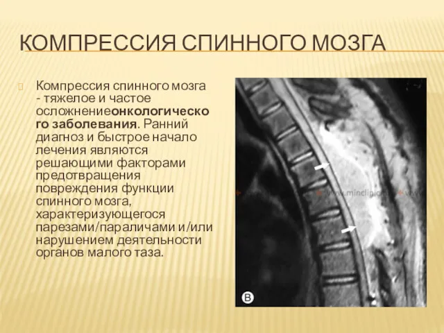 КОМПРЕССИЯ СПИННОГО МОЗГА Компрессия спинного мозга - тяжелое и частое