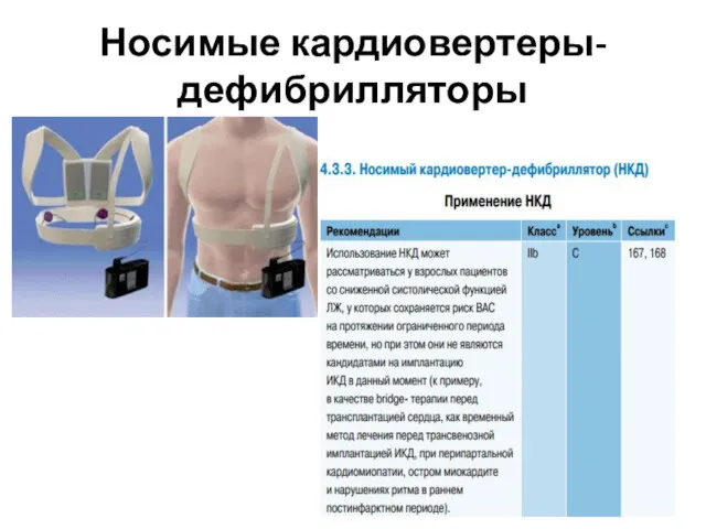 Носимые кардиовертеры-дефибрилляторы