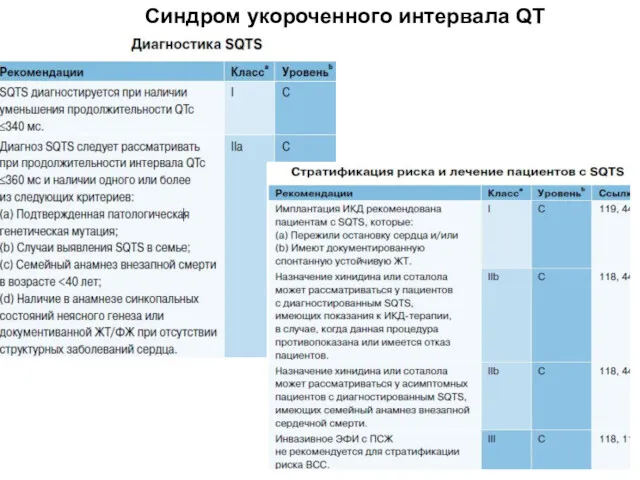 Синдром укороченного интервала QT