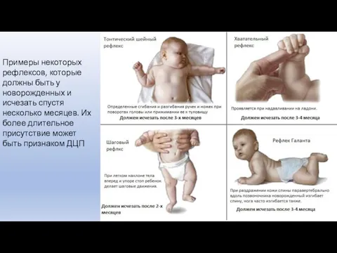 Примеры некоторых рефлексов, которые должны быть у новорожденных и исчезать спустя несколько месяцев.