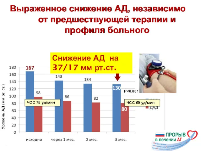 Уровень АД (мм рт. ст.) Р Выраженное снижение АД, независимо