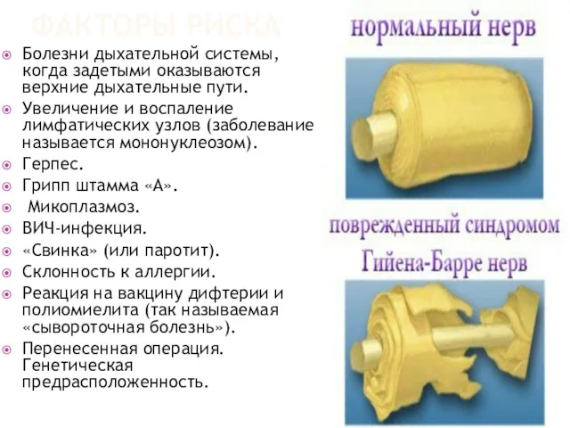 ФАКТОРЫ РИСКА Болезни дыхательной системы, когда задетыми оказываются верхние дыхательные