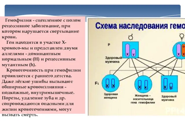 Гемофилия - сцепленное с полом рецессивное заболевание, при котором нарушается