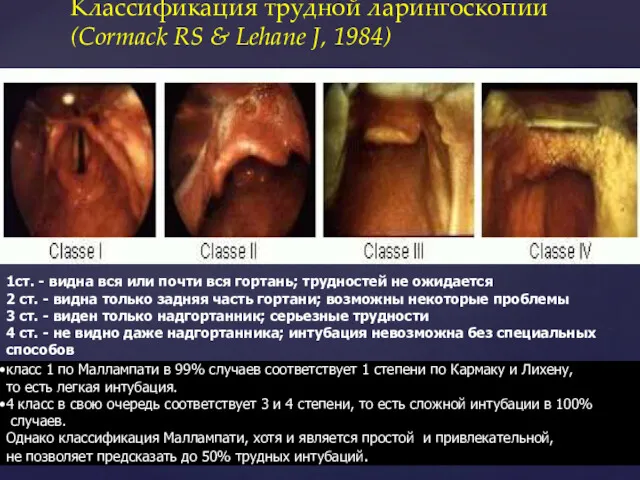 Классификация трудной ларингоскопии (Cormack RS & Lehane J, 1984) 1ст.