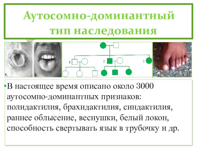 Аутосомно-доминантный тип наследования В настоящее время описано около 3000 аутосомно-доминантных