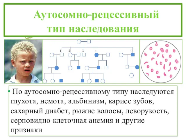 Аутосомно-рецессивный тип наследования По аутосомно-рецессивному типу наследуются глухота, немота, альбинизм,