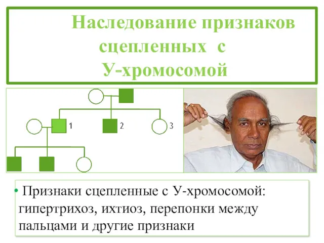 Наследование признаков сцепленных с У-хромосомой Признаки сцепленные с У-хромосомой: гипертрихоз,