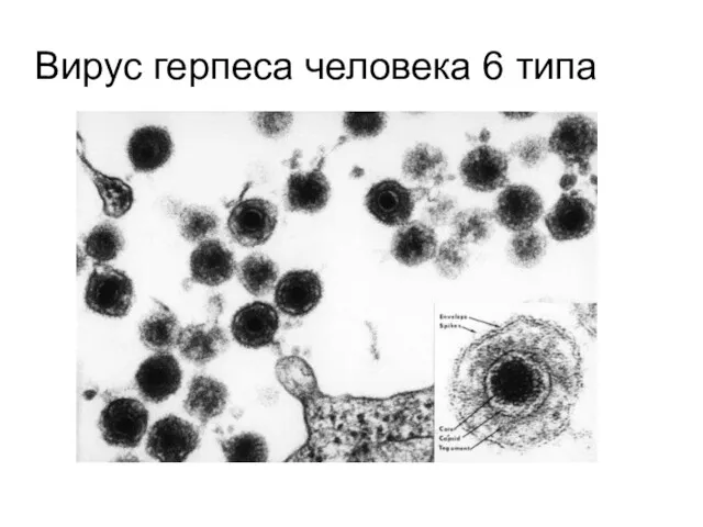 Вирус герпеса человека 6 типа