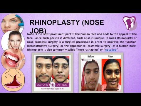 RHINOPLASTY (NOSE JOB) Nose is the most prominent part of the human face