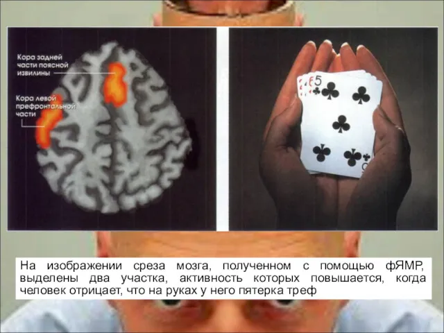 На изображении среза мозга, полученном с помощью фЯМР, выделены два