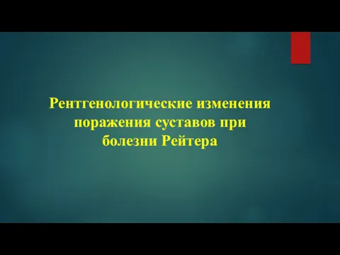 Рентгенологические изменения поражения суставов при болезни Рейтера