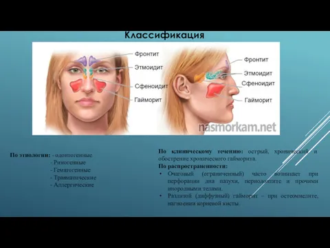 По этиологии: - одонтогенные - Риногенные - Гематогенные - Травматические - Аллергические По