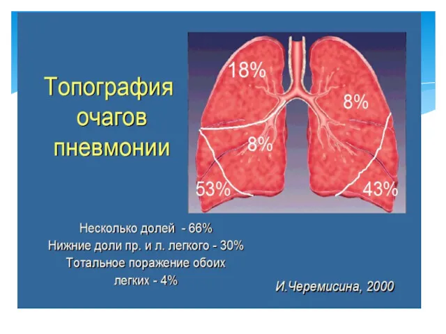 ТОПОГРАФИЯ ОЧАГОВ ПНЕВМОНИИ