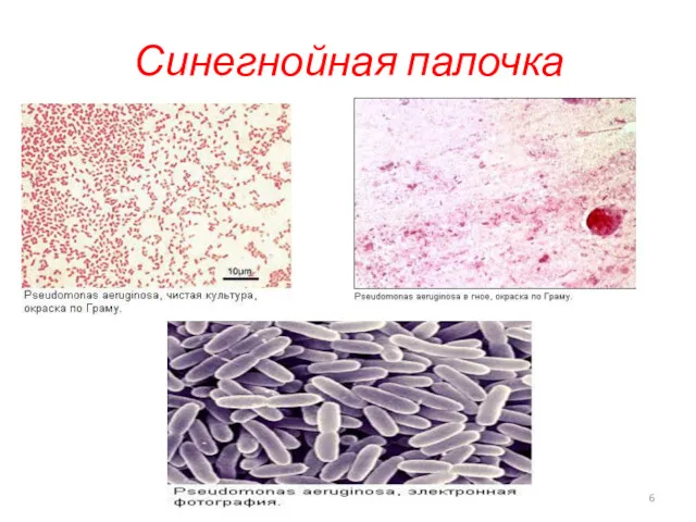 Синегнойная палочка