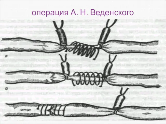 операция А. Н. Веденского