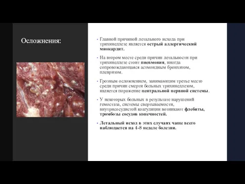 Осложнения: Главной причиной летального исхода при трихинеллезе является острый аллергический